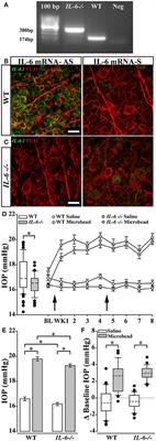 Interleukin-6 Deficiency Attenuates Retinal Ganglion Cell Axonopathy and Glaucoma-Related Vision Loss